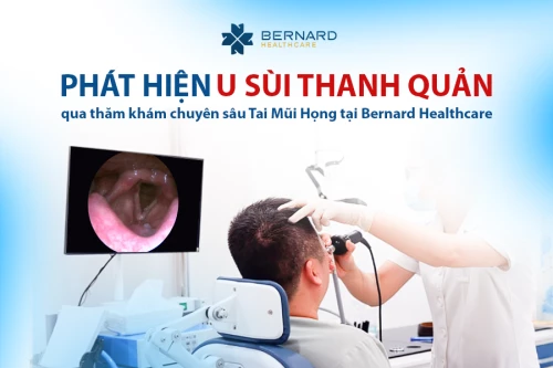 Bất ngờ phát hiện u sùi thanh quản qua thăm khám chuyên sâu tai mũi họng tại Bernard Healthcare